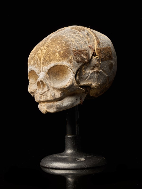 19th Century Papier-Mâché Fetal Skull-collectit-by-spectandum-001675-01-2mb-main-637374834294903309.jpg