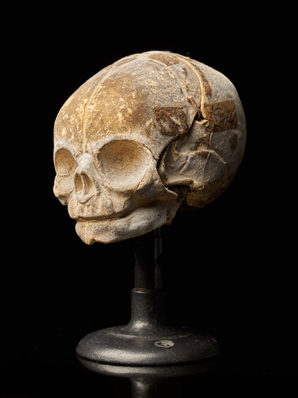 19th Century Papier-Mâché Fetal Skull-collectit-by-spectandum-001675-02-2mb-main-637627340943302278.jpg