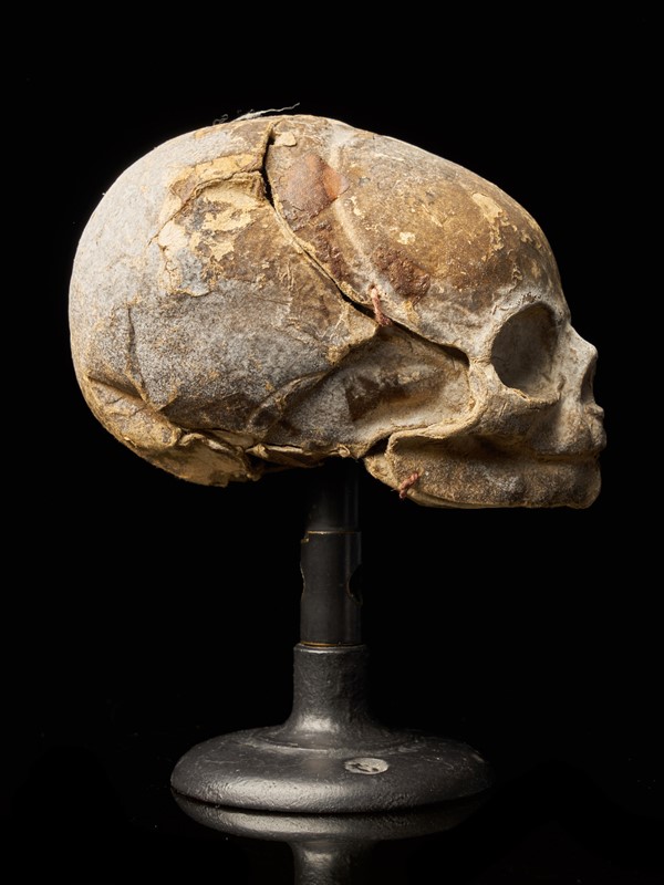 19th Century Papier-Mâché Fetal Skull-collectit-by-spectandum-001675-05-2mb-main-637374834448656135.jpg