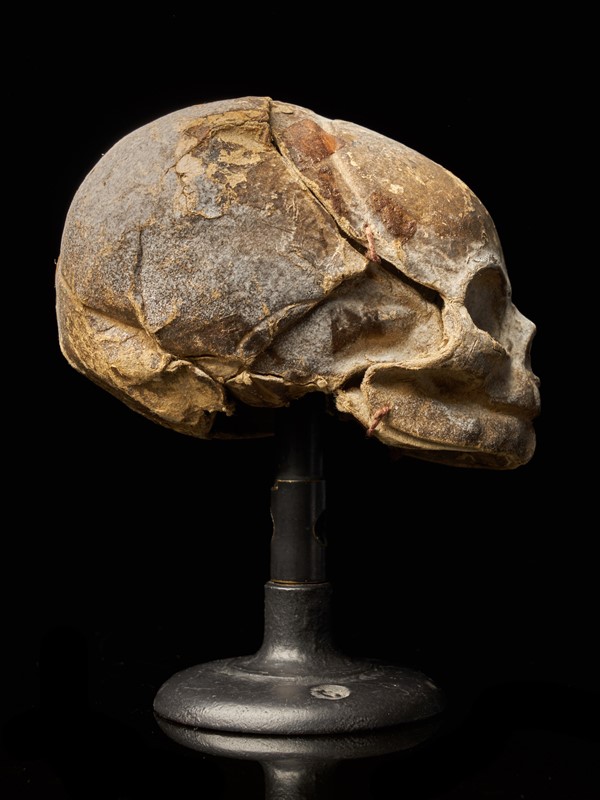 19th Century Papier-Mâché Fetal Skull-collectit-by-spectandum-001675-06-2mb-main-637374834459750050.jpg