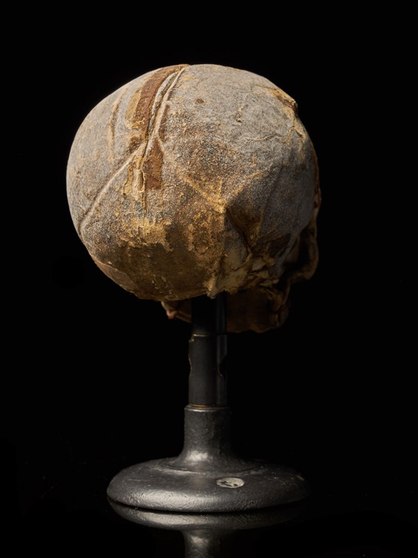 19th Century Papier-Mâché Fetal Skull-collectit-by-spectandum-001675-07-2mb-main-637627340995801784.jpg
