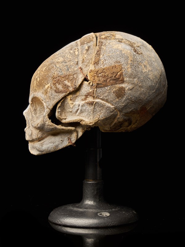 19th Century Papier-Mâché Fetal Skull-collectit-by-spectandum-001675-09-2mb-main-637374834493162956.jpg