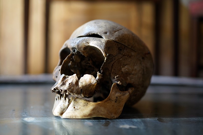 19thC Phrenologically Inscribed Human Skull-doe-and-hope-humaninscribedmedicalskull10-main-637594425688209546.jpg