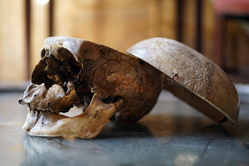 19thC Phrenologically Inscribed Human Skull-doe-and-hope-humaninscribedmedicalskull12-main-637594426148832628.jpg