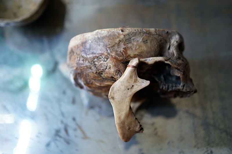 19thC Phrenologically Inscribed Human Skull-doe-and-hope-humaninscribedmedicalskull13-main-637594426155707208.jpg