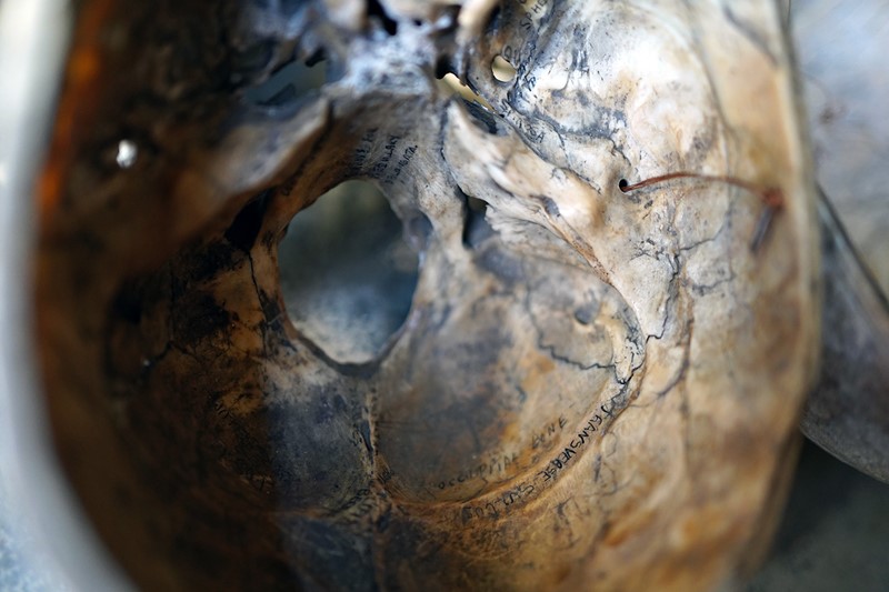 19thC Phrenologically Inscribed Human Skull-doe-and-hope-humaninscribedmedicalskull14-main-637594426167270101.jpg