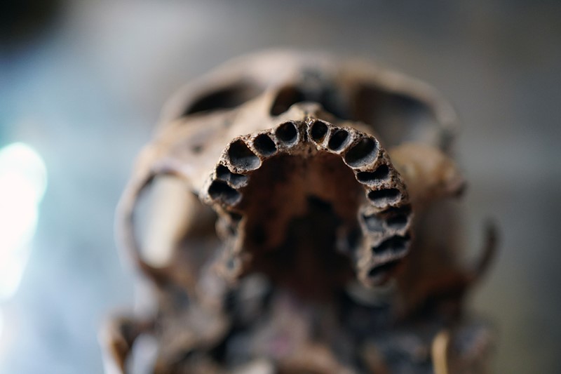 19thC Phrenologically Inscribed Human Skull-doe-and-hope-humaninscribedmedicalskull22-main-637594426398048737.jpg