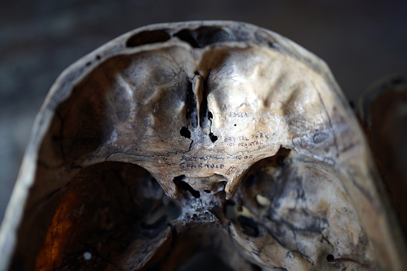 19thC Phrenologically Inscribed Human Skull-doe-and-hope-humaninscribedmedicalskull23-main-637594426404298800.jpg