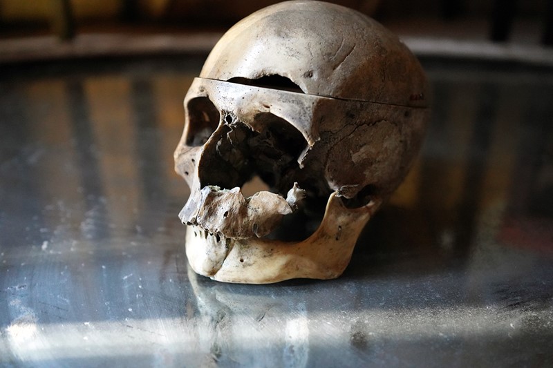 19thC Phrenologically Inscribed Human Skull-doe-and-hope-humaninscribedmedicalskull3-main-637594424121186353.jpg