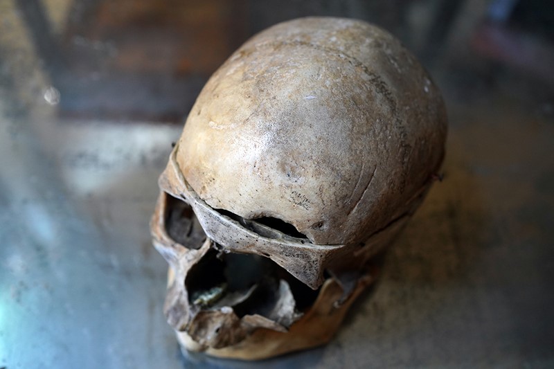 19thC Phrenologically Inscribed Human Skull-doe-and-hope-humaninscribedmedicalskull4-main-637594425619929164.jpg