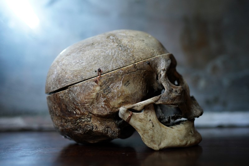 19thC Phrenologically Inscribed Human Skull-doe-and-hope-humaninscribedmedicalskull6-main-637594425631491098.jpg