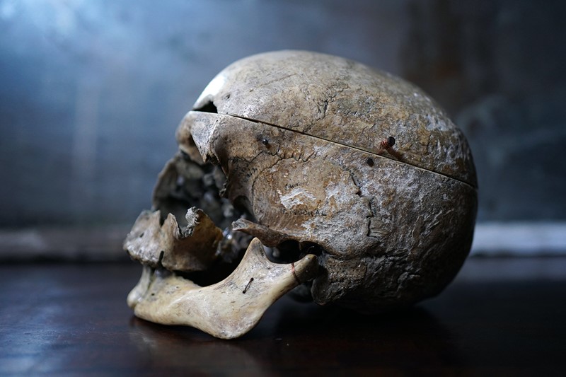 19thC Phrenologically Inscribed Human Skull-doe-and-hope-humaninscribedmedicalskull8-main-637594425669928358.jpg
